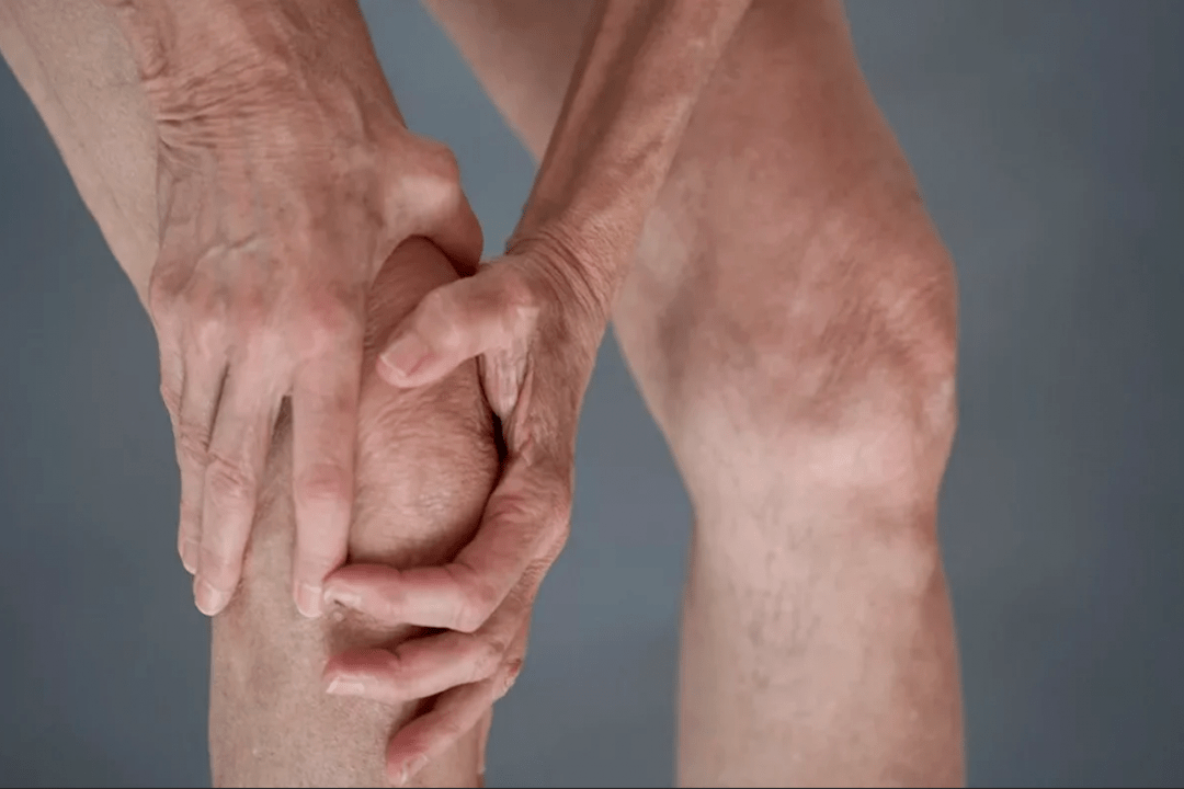 Joint pain may be the cause of arthritis or arthritis
