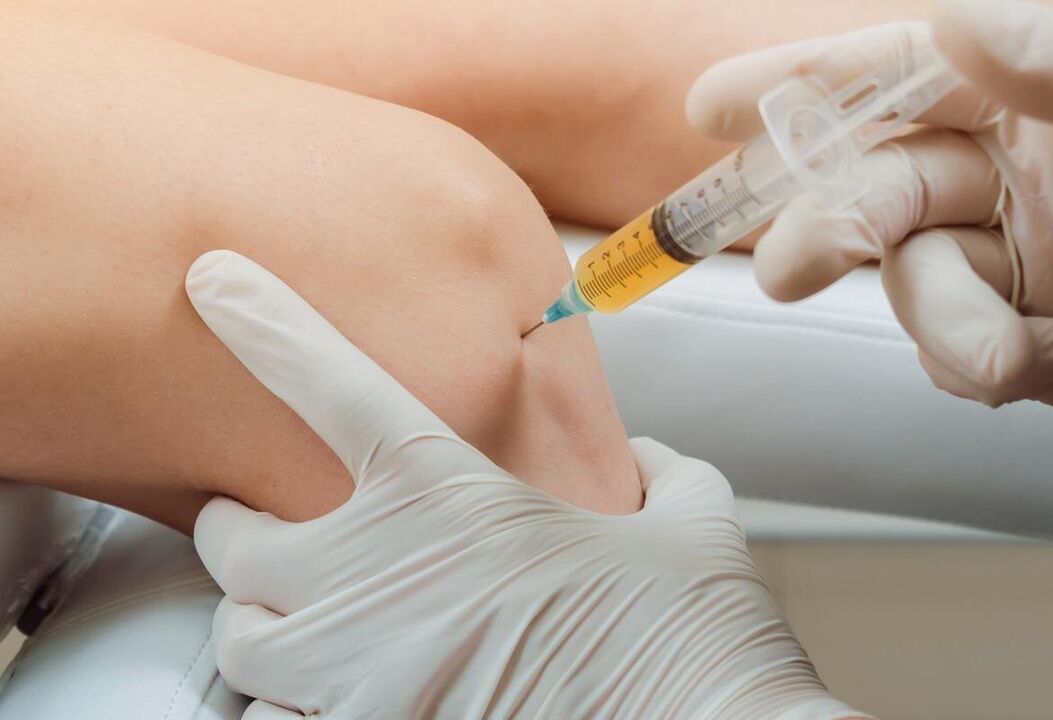 Joint Plasma Lift - The patient's plasma is introduced into the joint cavity of the joint pain