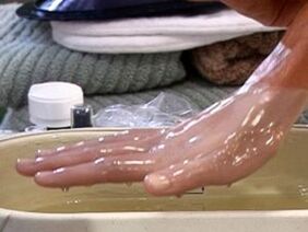 Paraffin Wax Treatment for Arthritis