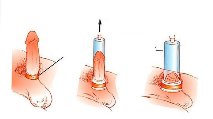 How vacuum pump works