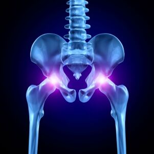 Hip pain can be acute, painful, or chronic