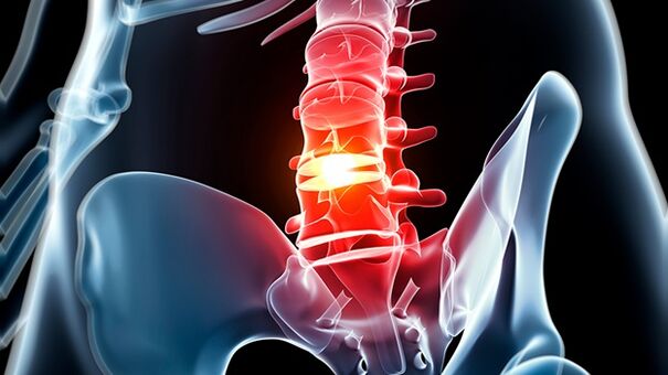 Bones and cartilage of the lumbar spine