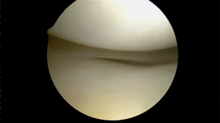 Astrological mirror view of perfectly healthy surface