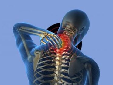 People with cervical osteochondrosis suffer from neck pain