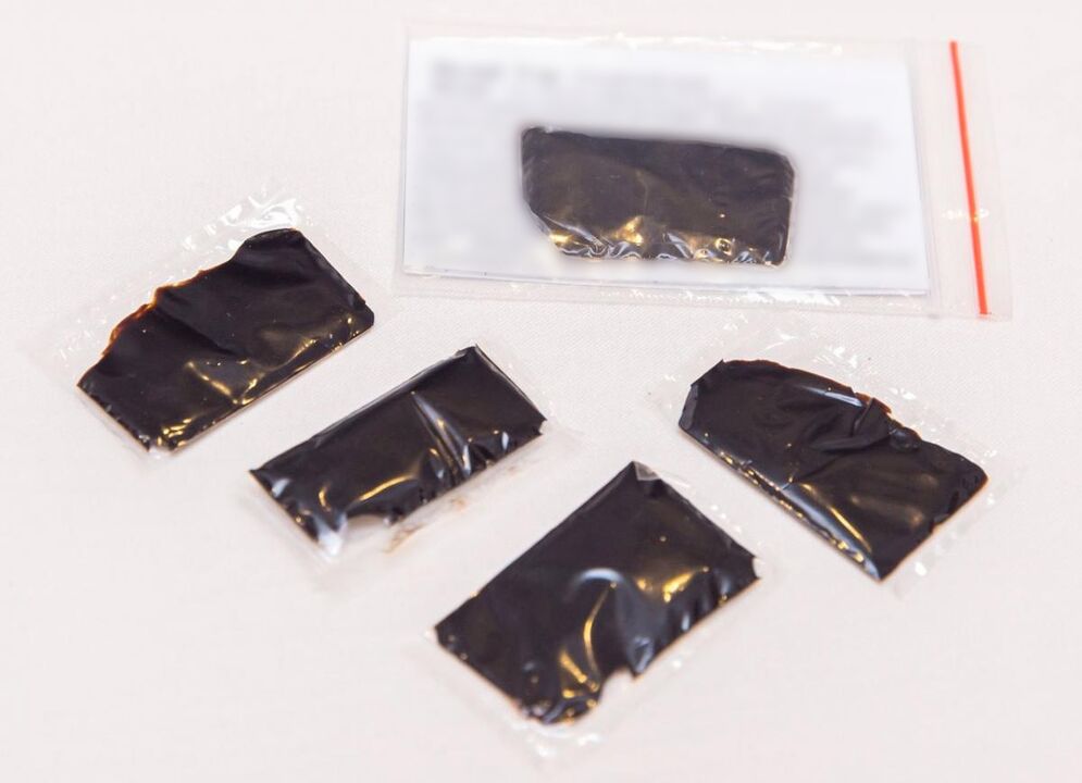 Shilajit is an effective treatment for cervical osteochondrosis at home